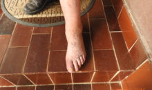 tromboflebitis, vnetje ven, krči v nogah ponoči noga po terapiji