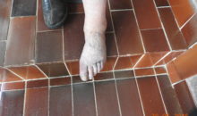 tromboza na nogi, ulkus, naravno zdravljenje, bioenergetik noga pred terapijo